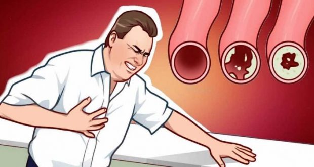 Как да оцелеем при инфаркт