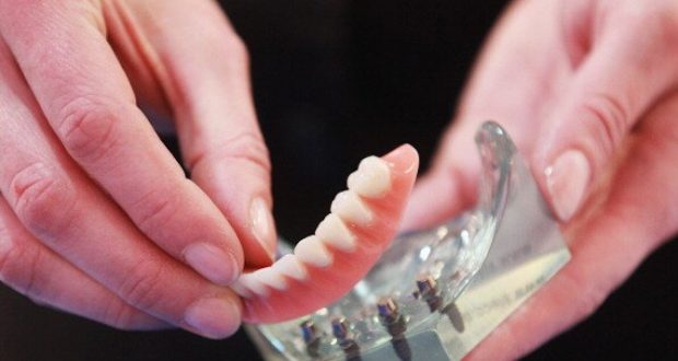 Зъбните протези