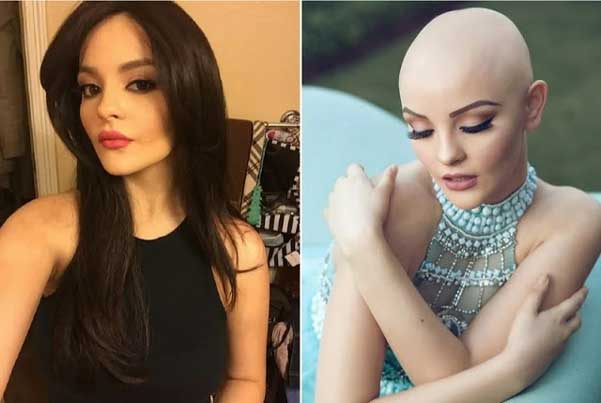 17-годишно момиче болно от рак