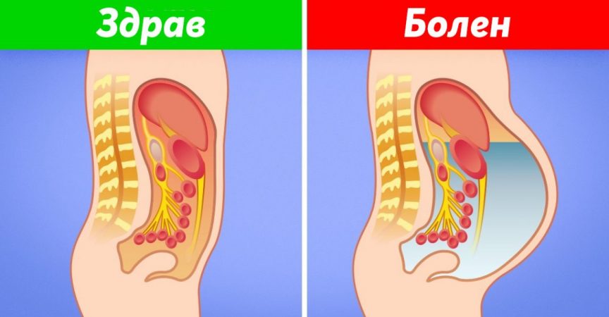 8 признака на чернодробно заболяване, които показват, че трябва да посетите лекар веднага