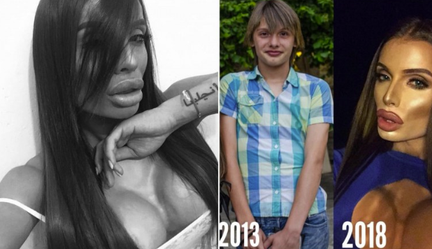 Трансджендърът Филип в разтърсваща изповед