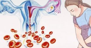 9 симптома на рак при жените