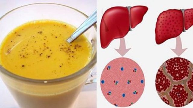 Детоксикация на черния дроб само за 1 седмица с това средство