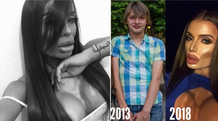 Трансджендърът Филип със сърцераздирателен разказ: Преминах през ада за да стана такъв