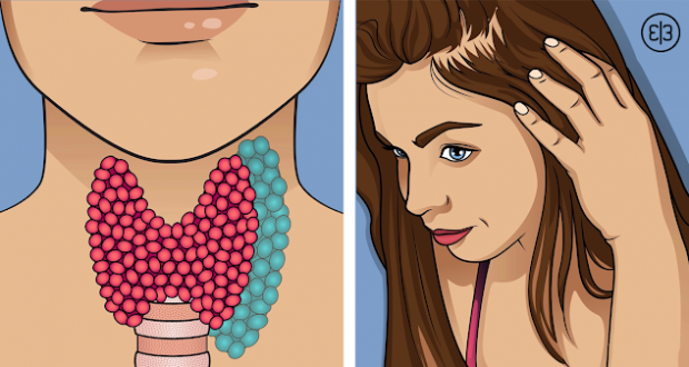 Всяка втора жена има проблем с щитовидната жлеза – 8 важни симптома които ежедневно пренебрегваме