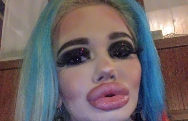 Българското Барби с 16-а операция