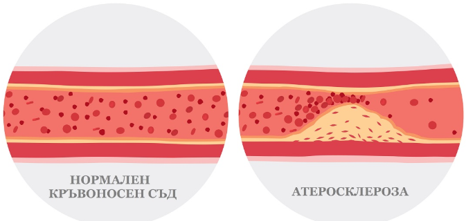 50 мл. от тази напитка прочиства артериите