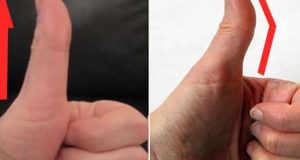 Палецът ви прав ли е или изкривен?
