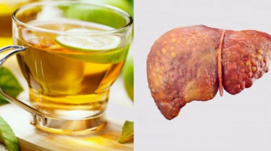 3 напитки прочистват черния дроб и премахват омазняването след 14 дни употреба