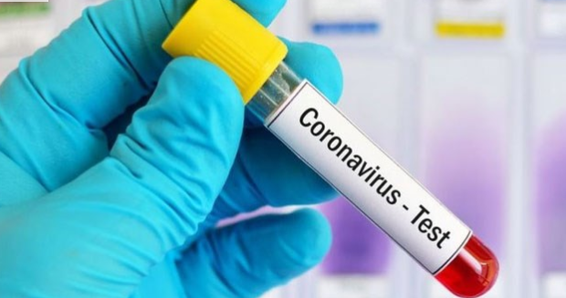 теста на украинеца със съмнения за коронавирус