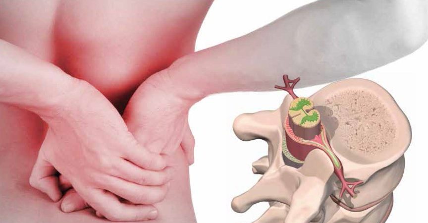 Наш народен лечител разби на пух и прах бялата мафия! Вижте как да се излекувате от дисковата херния за дни!