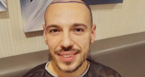 Даниел Петканов си присади коса
