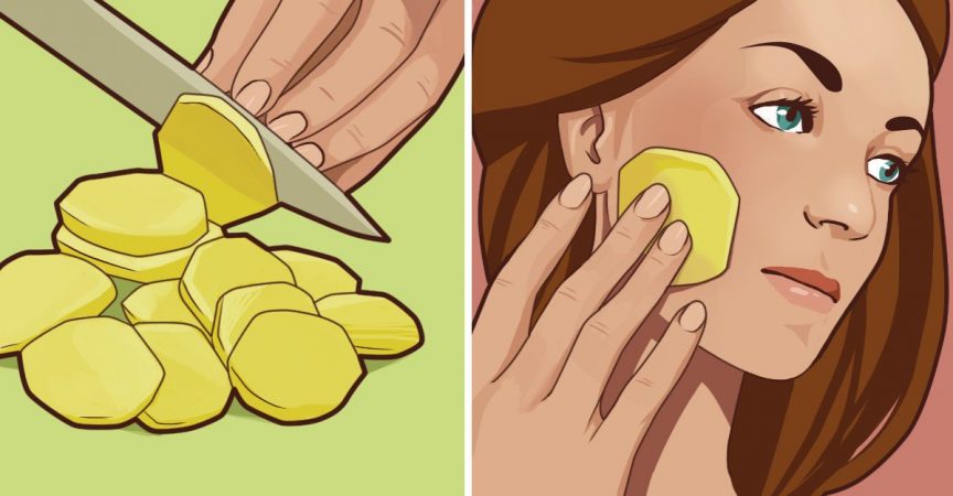 Всяка сутрин вземам 1 картоф режа го и мажа по лицето. Отначало всички ми се смееха но като видяха резултата останаха без думи