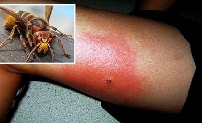 Дядо пчелар съветва: Направете това при ужилване от оса стършел или пчела и ядове няма да имате върши чудеса