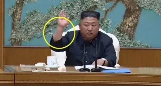 Медици видяха нещо на ръката на Ким Чен Ун 