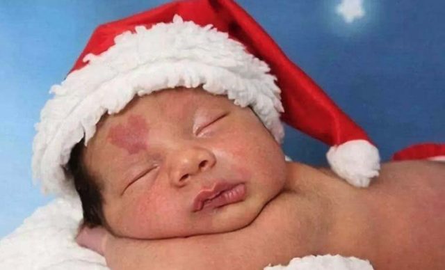 Как изглежда днес момчето което се роди с родилно петно във формата на сърце на челото