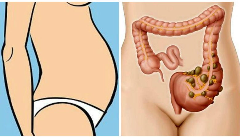 Как да намалим досадния стомах без хирургическа намеса?