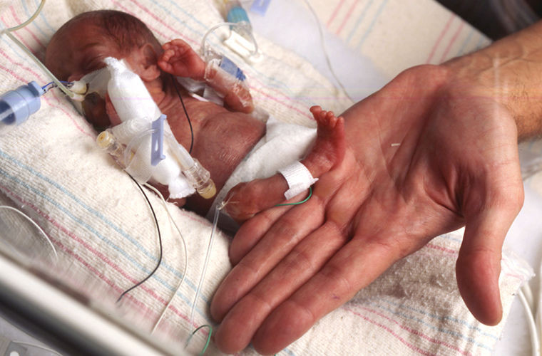 Помните ли миниатюрната Емилия която се роди едва 226 грама