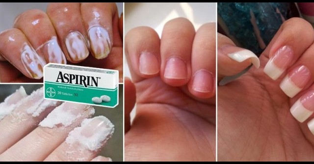 8 приложения на аспирина за които едва ли сте чували а ще ви бъдат в помощ със сигурност
