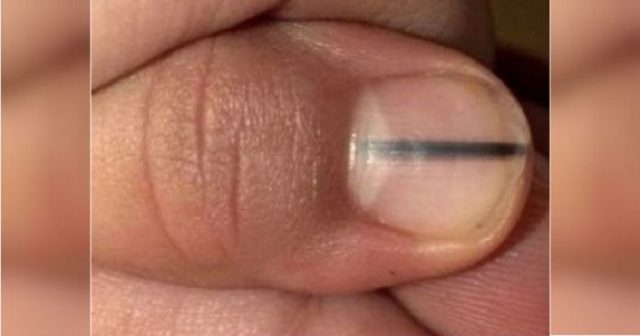 Ако сте с маникюр спешно вижте дали нямате тази линия под ноктите