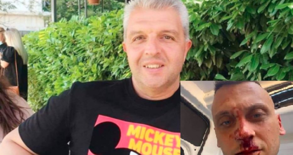 Журналистът Антон Стефанов: Сценична боя е по лицето на Флоров