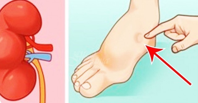 Един месец преди инсулт тялото ви изпраща тези предупредителни сигнали. Не ги пренебрегвайте за нищо на света!