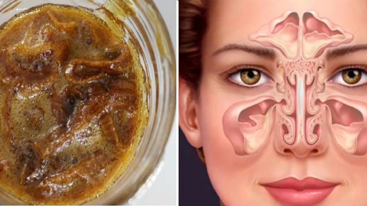 Лек против настинка: ще се почувствате много по-добре само за ден