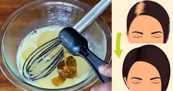 Накрая намерих средството което спря косопада ми! Забелязах ефекта още след първото приложение