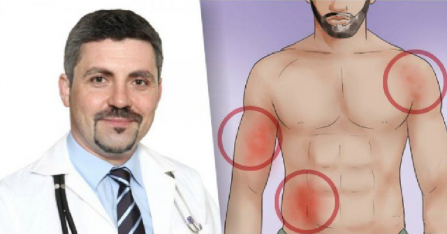 Как да хванете рак в ранен стадий: Важно съобщение от онколог!