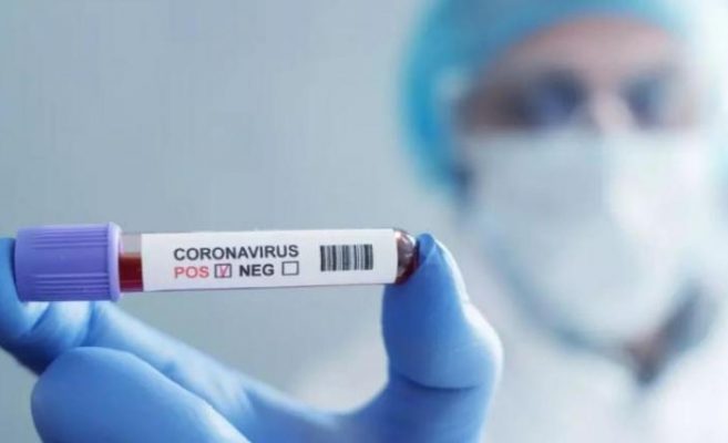 Ето как да разберете дали прекарвате коронавирус без симптоми