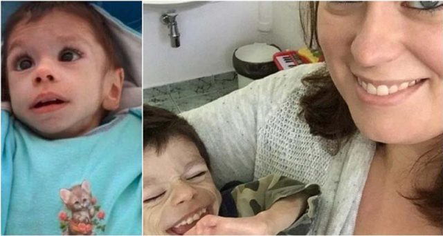 Жена осиновила момче което никой не искал. Ето как изглежда след година в новото семейство: