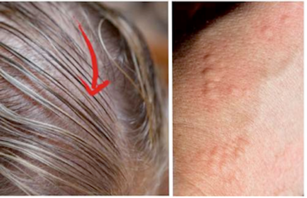 Щитовидната жлеза – 8 признака които показват че имате проблем