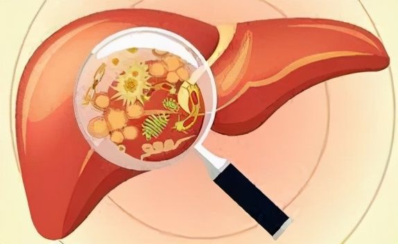 Елементарна рецепта за прочистване на черния дроб и бъбреците