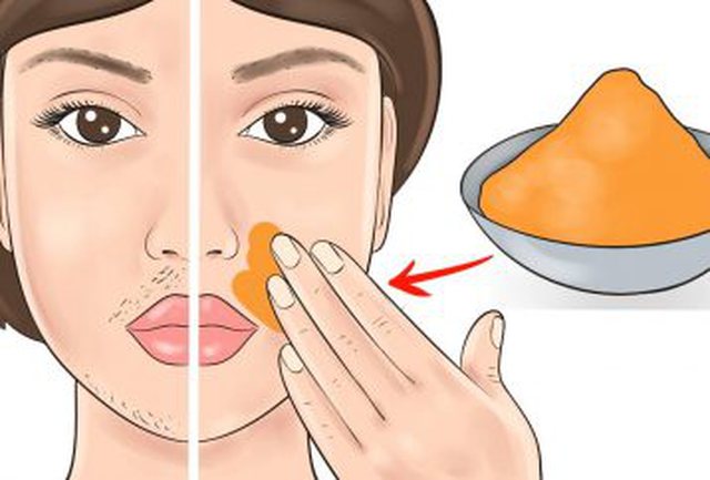 Косъмчетата по женската брадичка не само ни загрозяват но и са знак за опасно състояние: