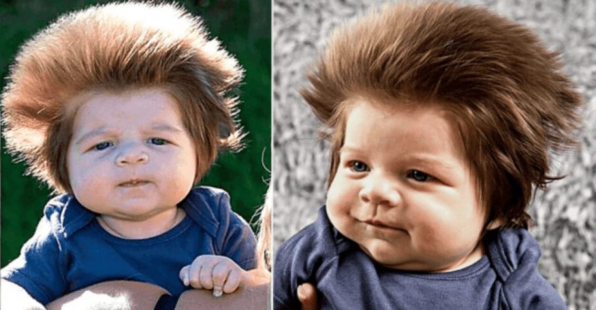 Помните ли 2-месечното бебе с най-гъстата коса? Вижте как изглежда днес (Снимки)