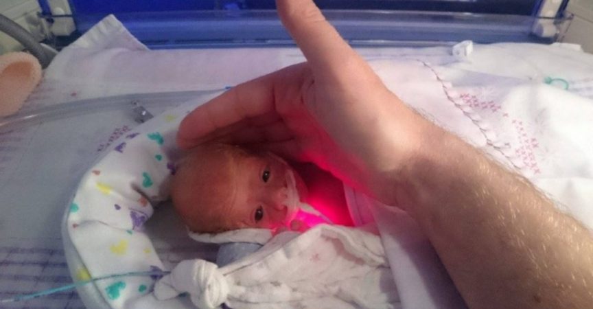 Тази малка принцеса се пребори за живота си а за да стоплят