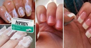 Всяка жена трябва да ги знае: 9 адски полезни ефекта от аспирина
