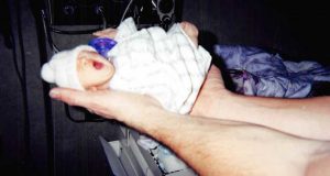 Ето как изглежда 20 години по-късно бебето което се роди едва 900 грама-Снимки и видео